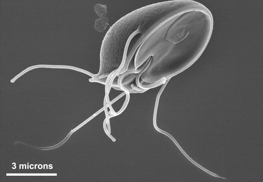 Human giardia close-up